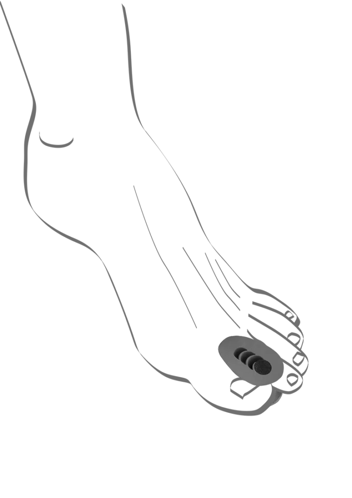 Abbildung einer Fußskizze mit einem Zehenspreizer Para zwischen der ersten und zweiten Zehe. Der elastische Kunststoffspreizer verfügt über einen austauschbaren schwarzen Einsatz und trennt die Zehen sanft, um Reibung und Druckstellen zu vermeiden. Ideal zur Entlastung bei Hallux valgus oder eng anliegenden Zehen.