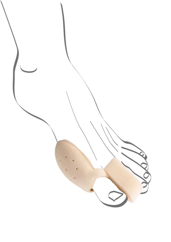 Abbildung einer Fußskizze mit Ballenbett von Berkemann. Das hautfarbene, weich gepolsterte Polster liegt unter dem Ballen und wird mit einer Schlaufe an der Großzehe fixiert. Es entlastet den Vorfuß, lindert Druck- und Schmerzstellen und sorgt für angenehmen Gehkomfort.