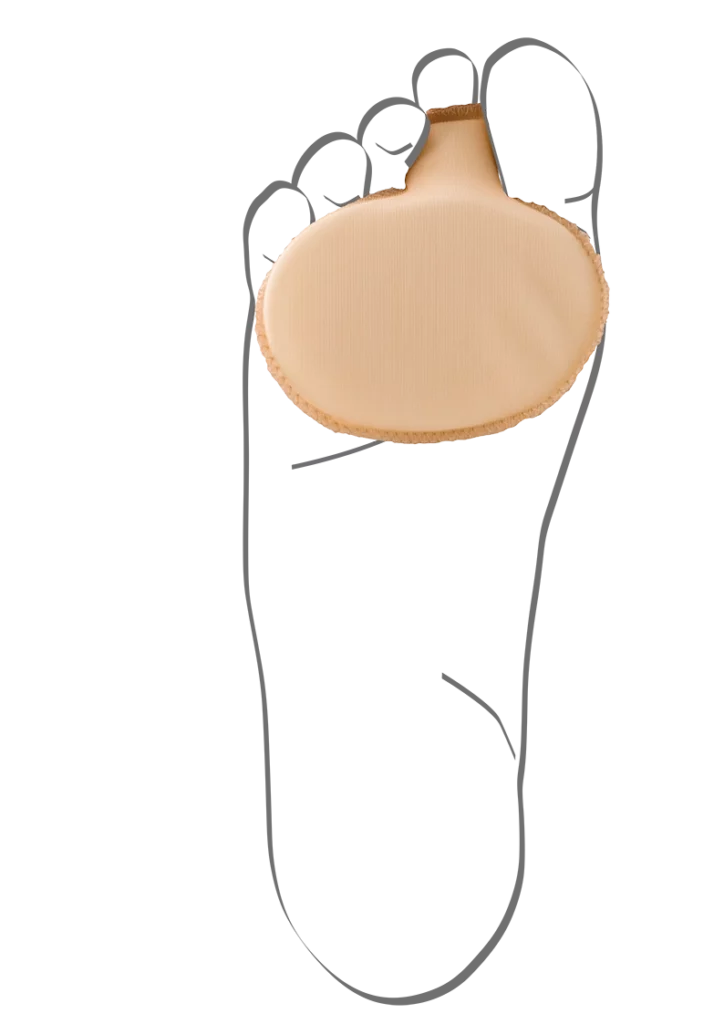 Abbildung einer Fußskizze mit Vorfusspolster von Berkemann. Das hautfarbene, weich gepolsterte Kissen liegt unter dem Ballen und wird über die zweite Zehe fixiert. Es entlastet den Vorfuß, lindert Druckschmerzen und sorgt für mehr Komfort beim Gehen.