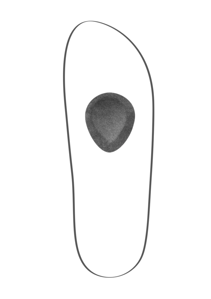 Abbildung einer Fußskizze mit eingezeichneter Spreizfuß-Pelotte. Die graue Pelotte ist mittig im Vorfußbereich positioniert und hebt das Quergewölbe sanft an, um den Mittelfuß zu entlasten und die natürliche Fußstellung bei Spreizfußbeschwerden zu unterstützen.