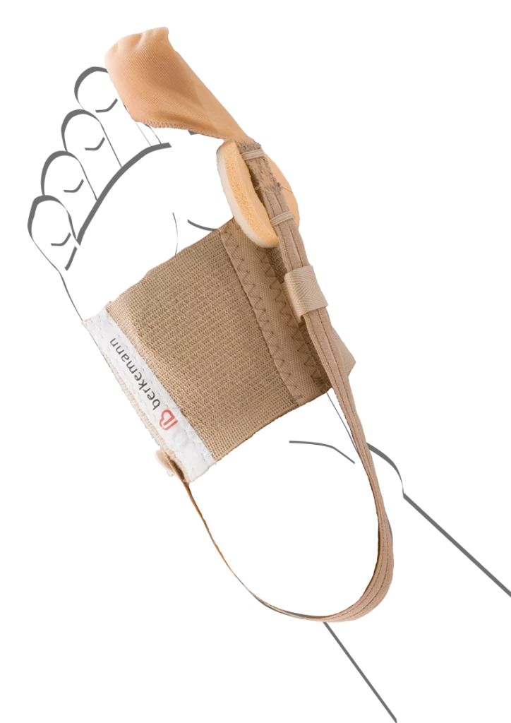 Abbildung einer Fußskizze mit angelegter Valex D Hallux-Valgus-Tagesbandage von Berkemann. Die hautfarbene Bandage wird mit einem elastischen Riemensystem über dem Mittelfuß fixiert und sanft um die Großzehe geführt. Sie korrigiert behutsam die Zehenstellung und unterstützt die natürliche Ausrichtung des Fußes im Alltag.