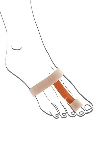 Abbildung einer Fußskizze mit Hammerzehen-Korrekturbandage von Berkemann. Die elastische Bandage mit orangefarbener Verbindungsschiene richtet sanft gekrümmte Zehen auf und entlastet die Gelenke. Sie sorgt für eine natürliche Zehenstellung und vermindert Reibung im Schuh.