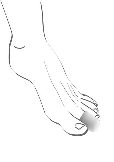 Abbildung einer Fußskizze mit einer Zehenkappe auf der großen Zehe. Die weiche Schaumstoffhülle umschließt die Zehe vollständig und schützt sie vor Druck, Reibung und schmerzhaften Stellen – ideal bei Hühneraugen, Blasen oder verdickter Haut.